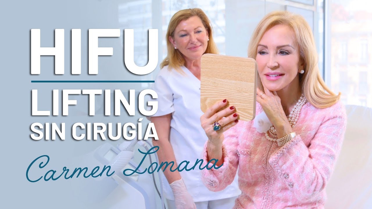 HIFU Facial: el Lifting SIN Cirugía de Carmen Lomana [Testimonio]