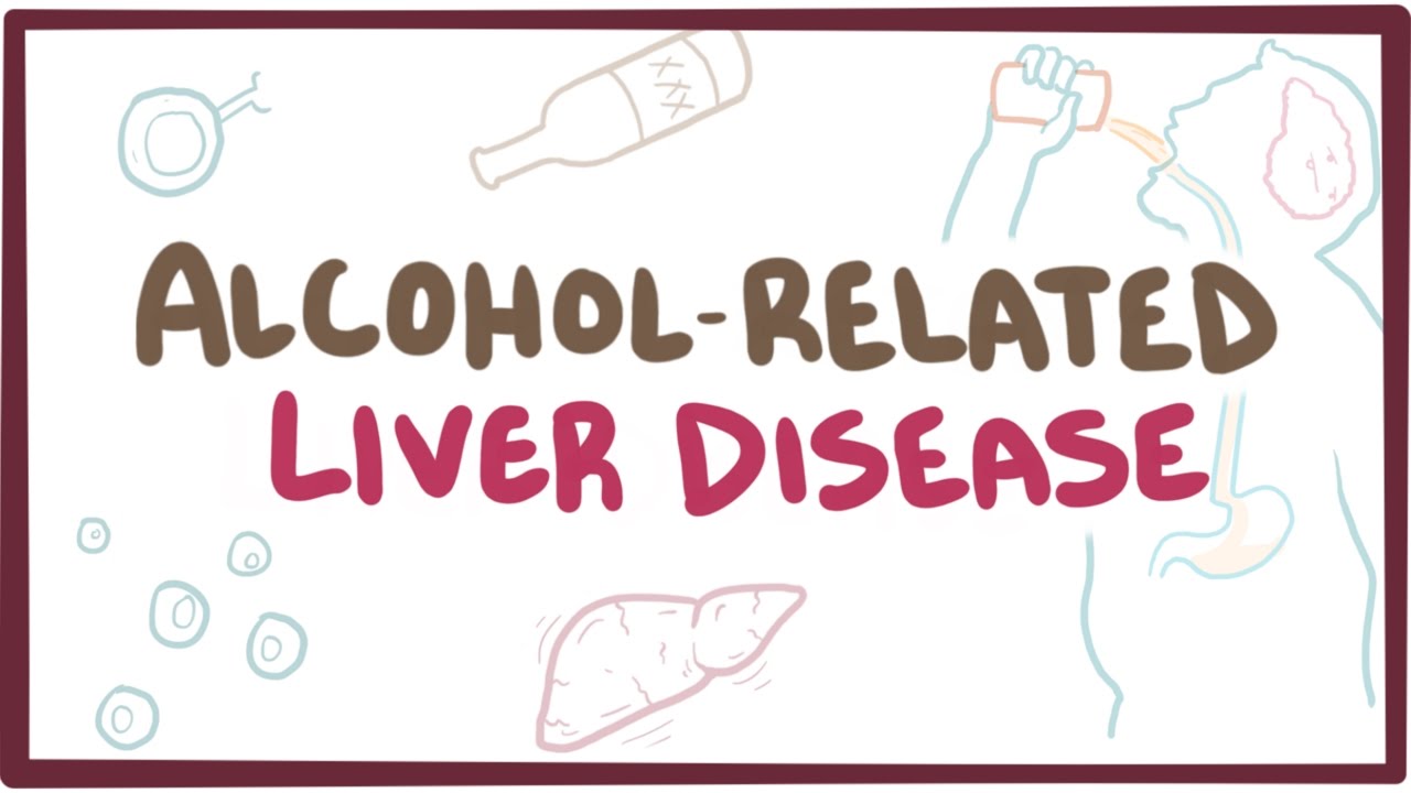 Alcohol-related liver disease - causes, symptoms \u0026 pathology