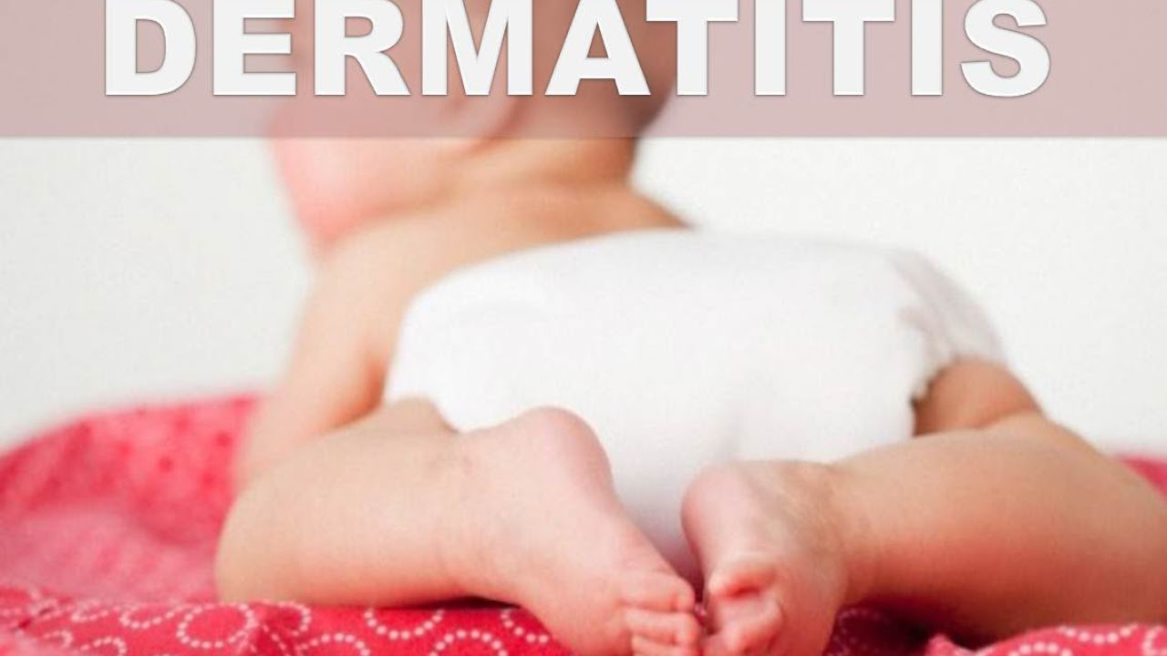 ☞ Remedios caseros para la dermatitis por pañal - Como aliviar el enrojecimiento por el uso de pañal