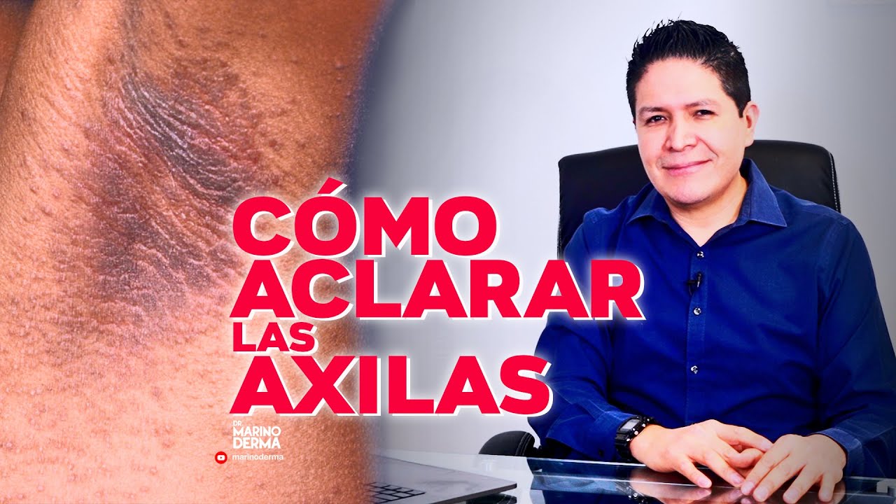 COMO ACLARAR LAS AXILAS | DR MARINO DERMATOLOGO