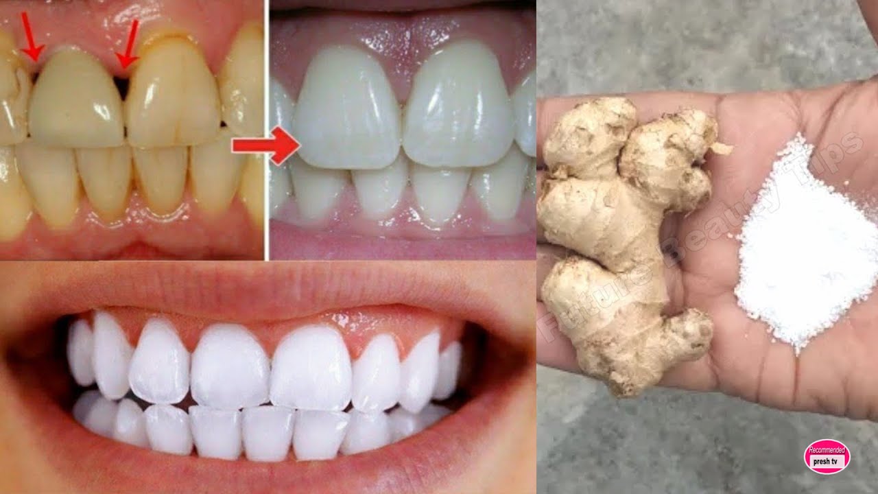 natural ways to whiten your teeth in 5 minutes with ginger and salt