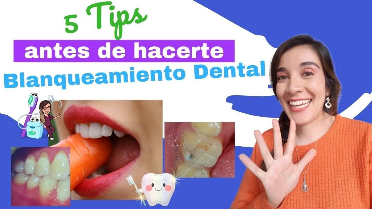 5 Tips Antes de hacerte un Blanquemiento Dental