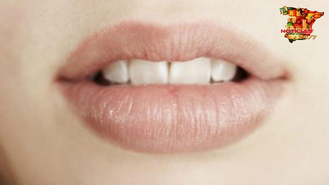 5 tips y remedios para curar los labios quemados