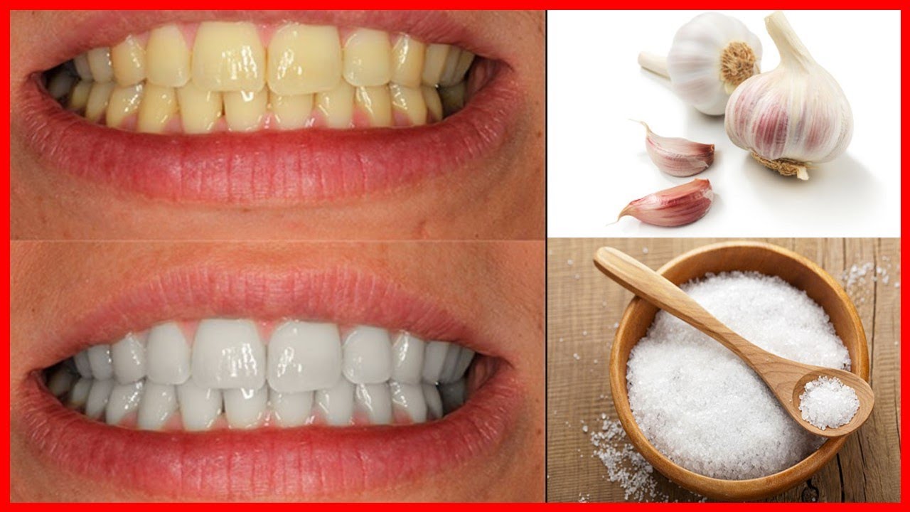 Blanqueamiento dental en solo 2 minutos 100% efectivo ¿como blanquear los dientes en casa?
