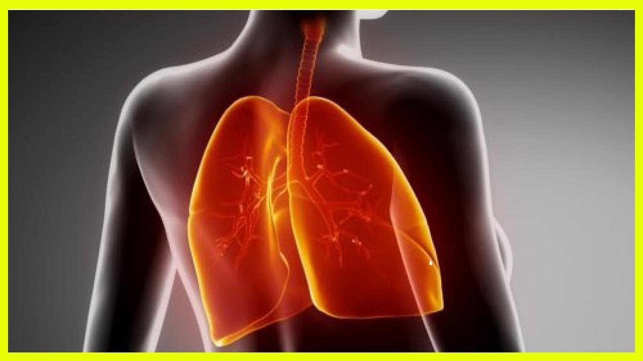 Cómo mejorar naturalmente la fibrosis pulmonar