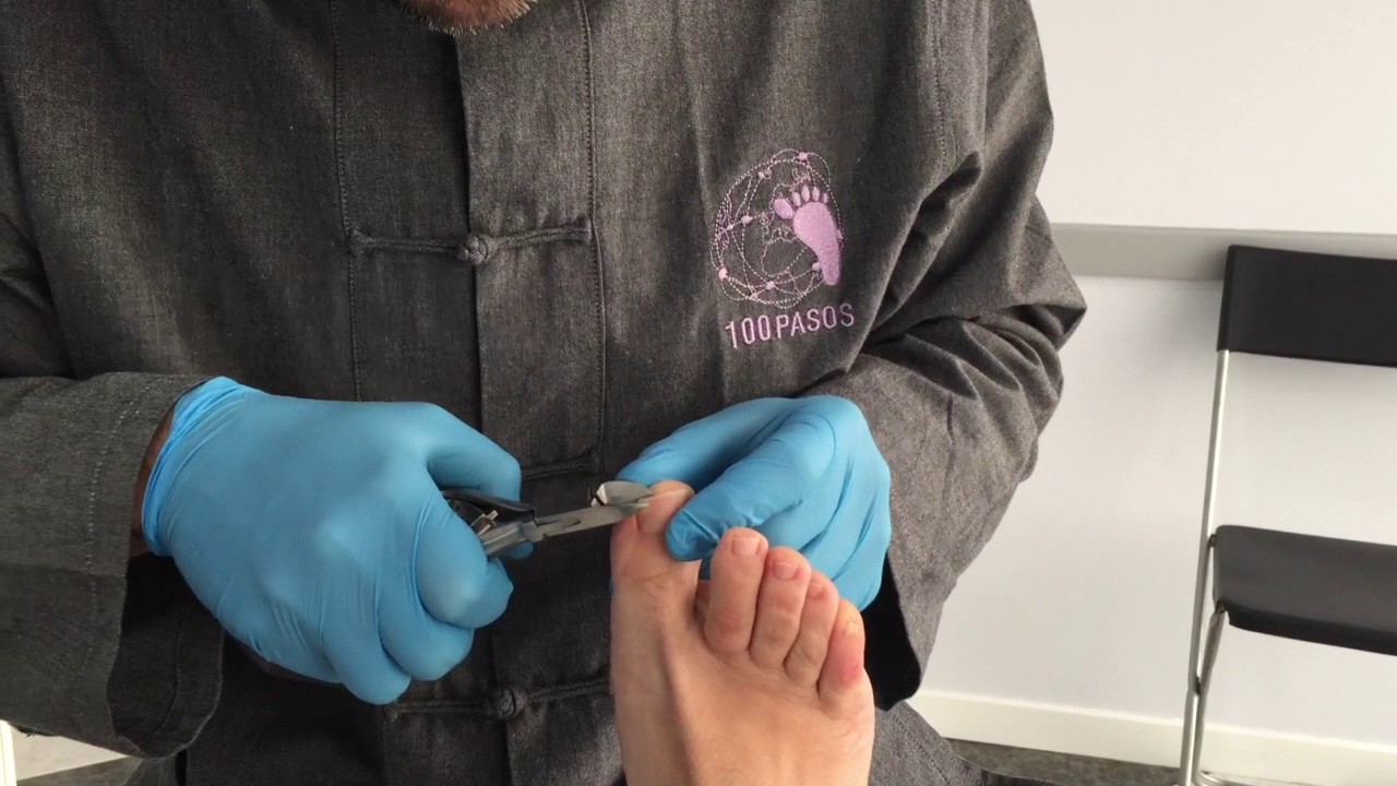 ¿Cómo se cortan las uñas de los pies?