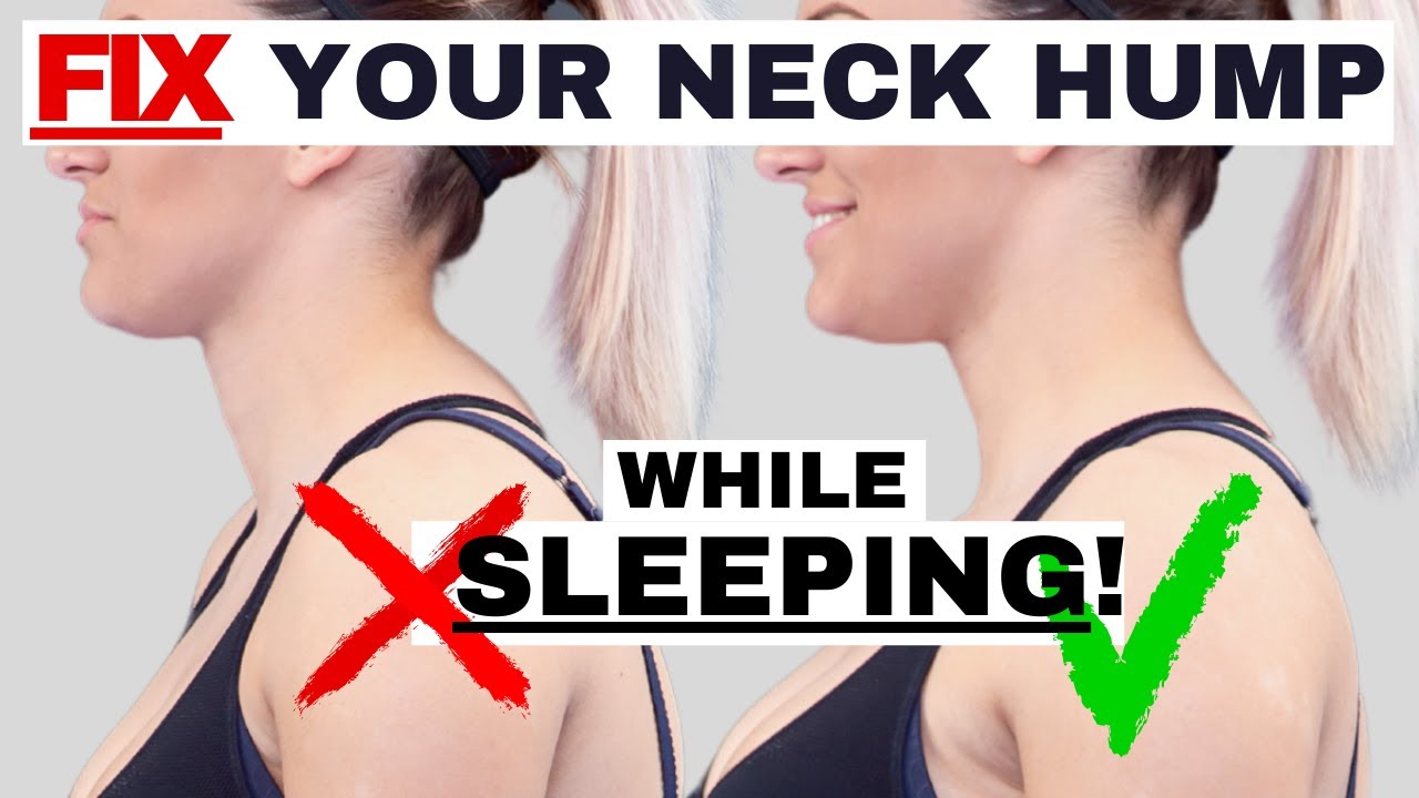 MEILLEURE position de sommeil pour FIXER la posture du cou, du bossu ou de la tête en avant | D...