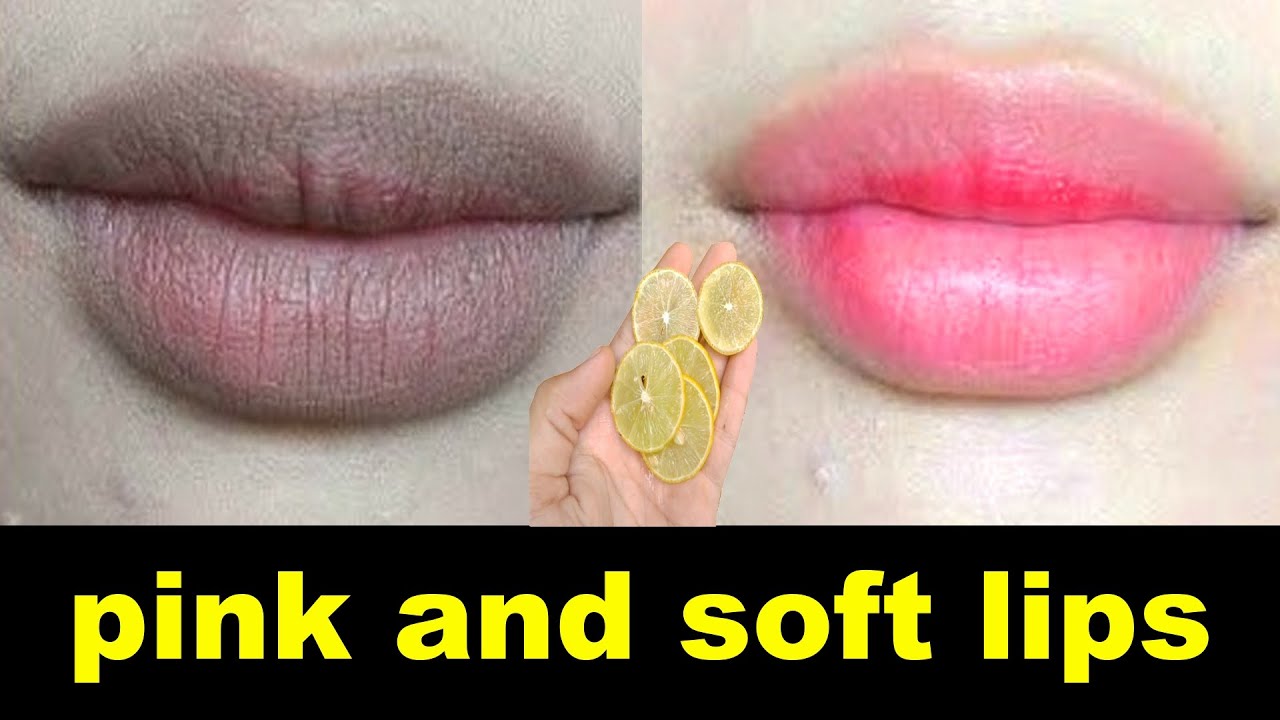 Obtenez des lèvres douces et roses de bébé naturellement en permanence à la maison | (100% fonctionnel)