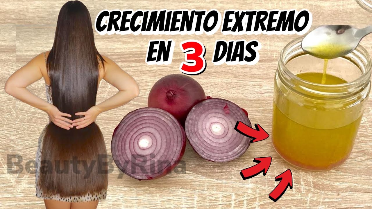 Remedio Poderoso para hacer CRECER EL CABELLO en 3 días/ DETIENE LA CAÍDA!