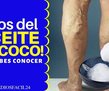 20 USOS DEL ACEITE DE COCO para tu Higiene Personal y Belleza ➜ Para que sirve el ACEITE DE COCO