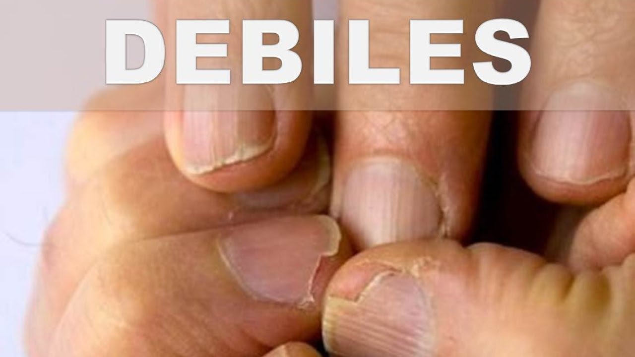 ☞ Remedios caseros para uñas débiles y quebradizas – Como darle vida a las uñas debilitadas