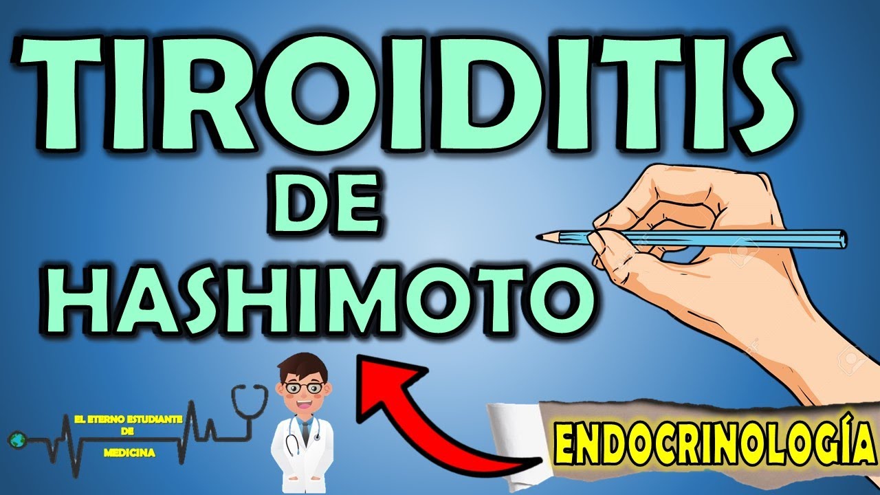 TIROIDITIS DE HASHIMOTO | TODO lo que DEBES SABER: Síntomas, Causas, Diagnóstico,Tratamiento⚡RESUMEN