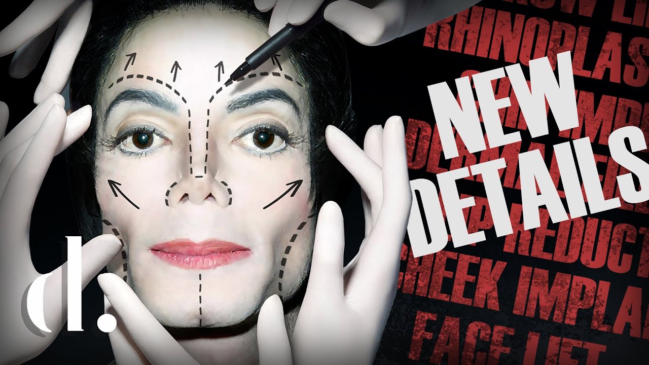 Combien de chirurgie plastique a réellement eu Michael Jackson? MISE À JOUR 2021 the detail