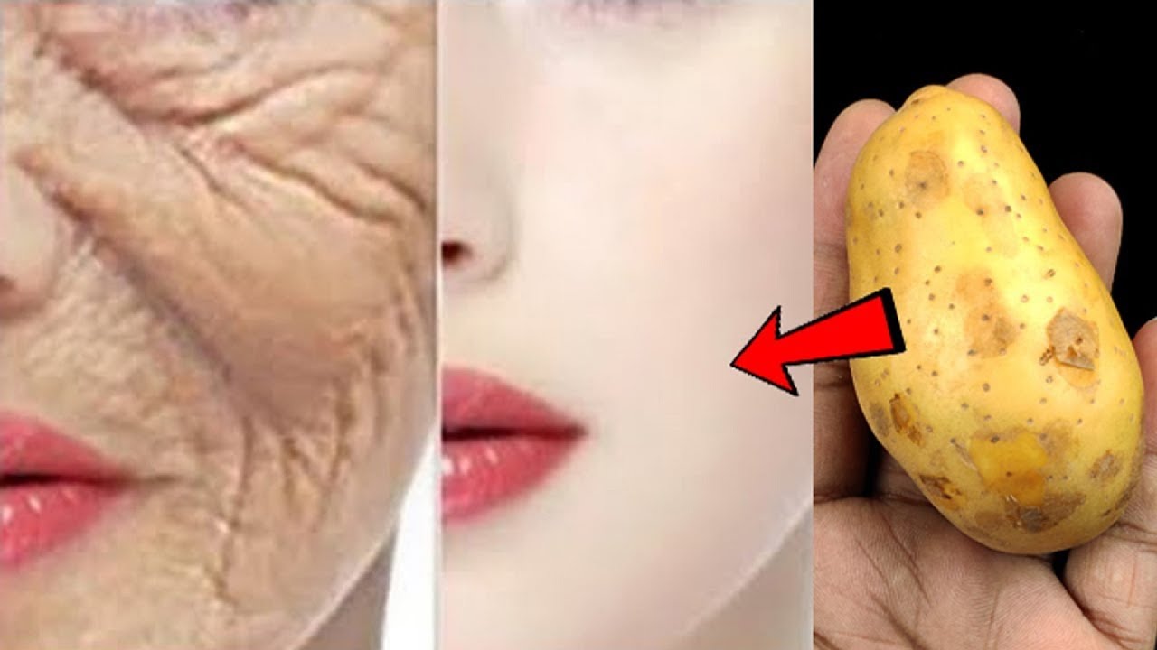 Japanese Secret To Look 10 Years Younger Than Your Age, Anti Aging Remedy To Remove Wrinkles
