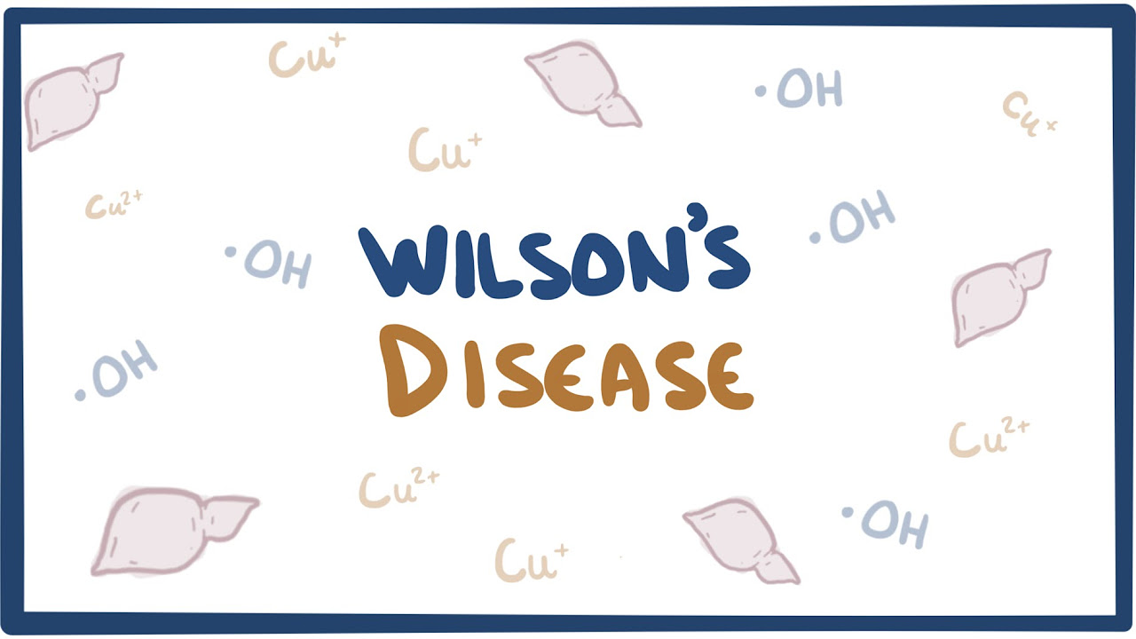 La maladie de Wilson: causes, symptômes, diagnostic, traitement et pathologie