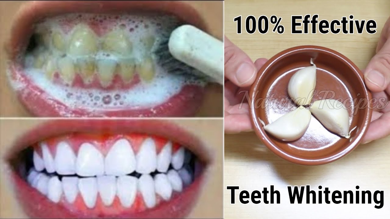 Teeth Whitening At Home In 3 Minutes How To Whiten Your Teeth Naturally 100% Effective