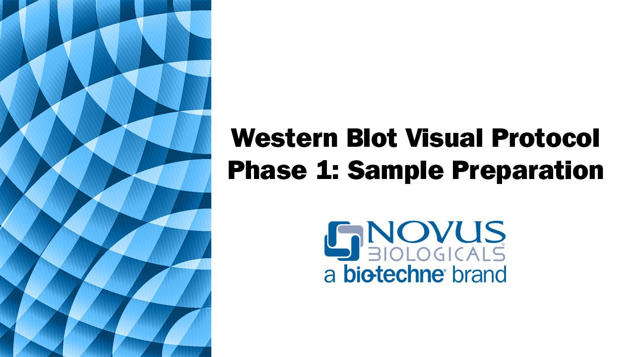 Western Blot Visual Protocol: Phase 1: Sample Preparation