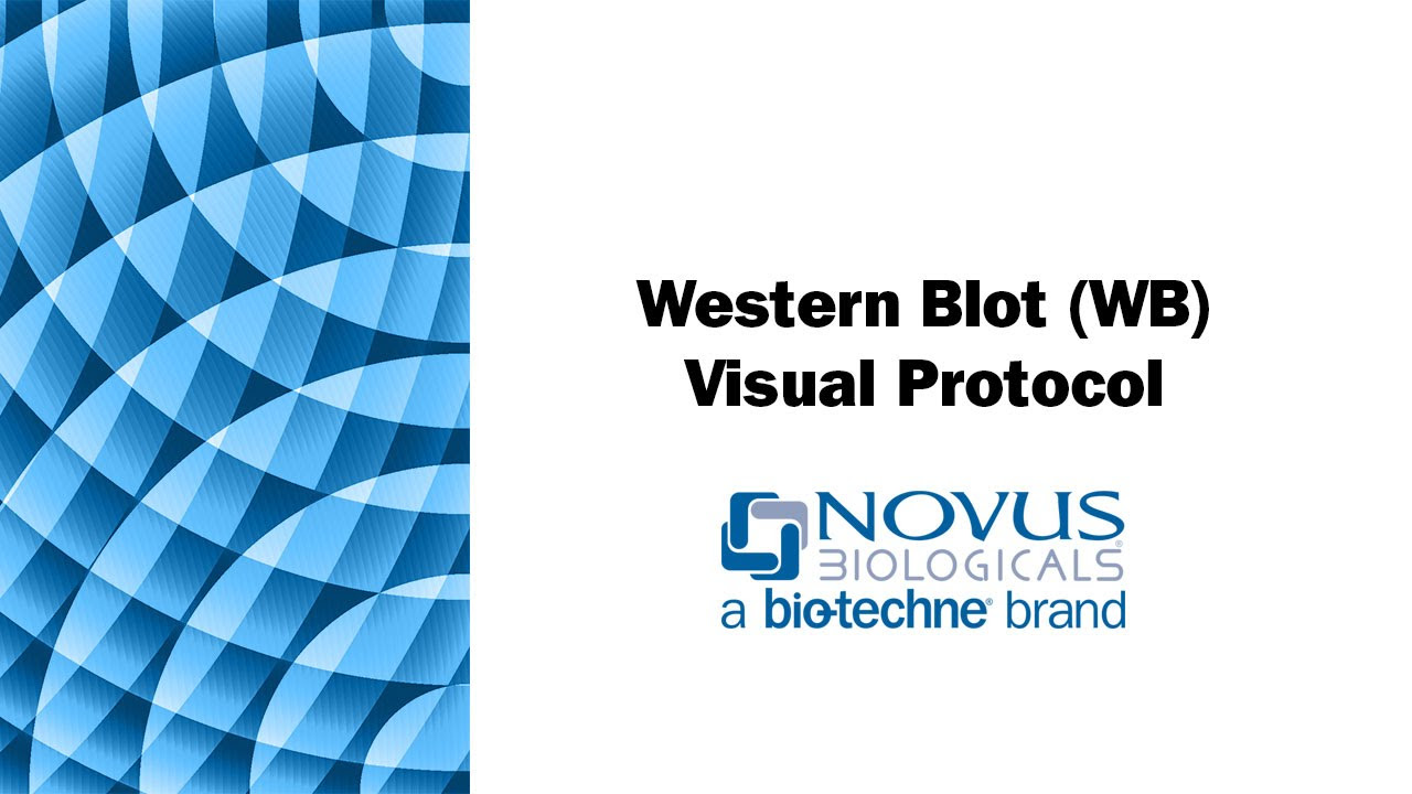 Western Blot (WB) Visual Protocol