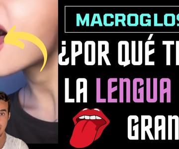 ¿Por qué tienen la LENGUA tan GRANDE y LARGA? - MACROGLOSIA