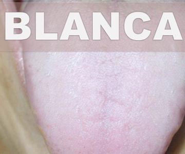 ☞ Remedios caseros para la lengua blanca – Como eliminar o quitar capa blanca de la lengua