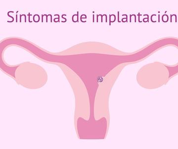 Síntomas de implantación del embrión