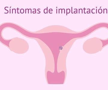 Síntomas de implantación del embrión