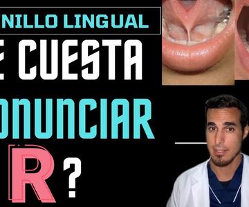 ¿Te cuesta PRONUNCIAR la letra R? - Frenillo lingual corto