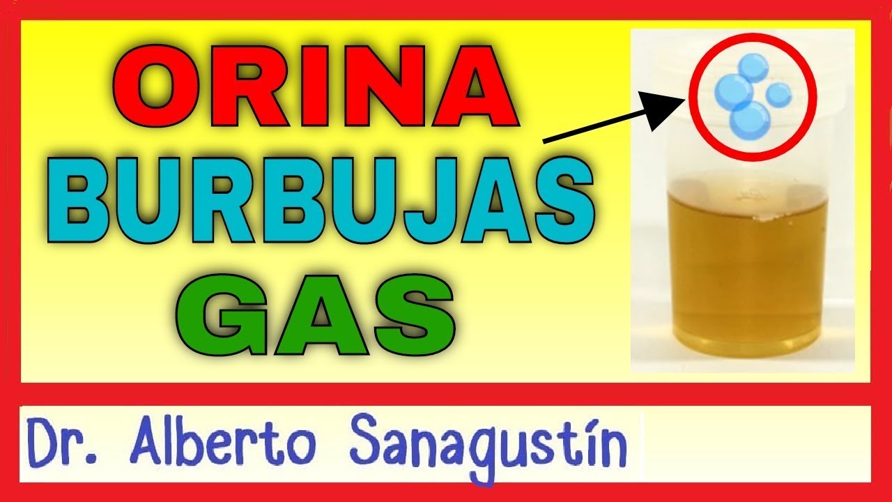 ¿Por qué tengo ORINA con BURBUJAS? (gas en la orina) 💦