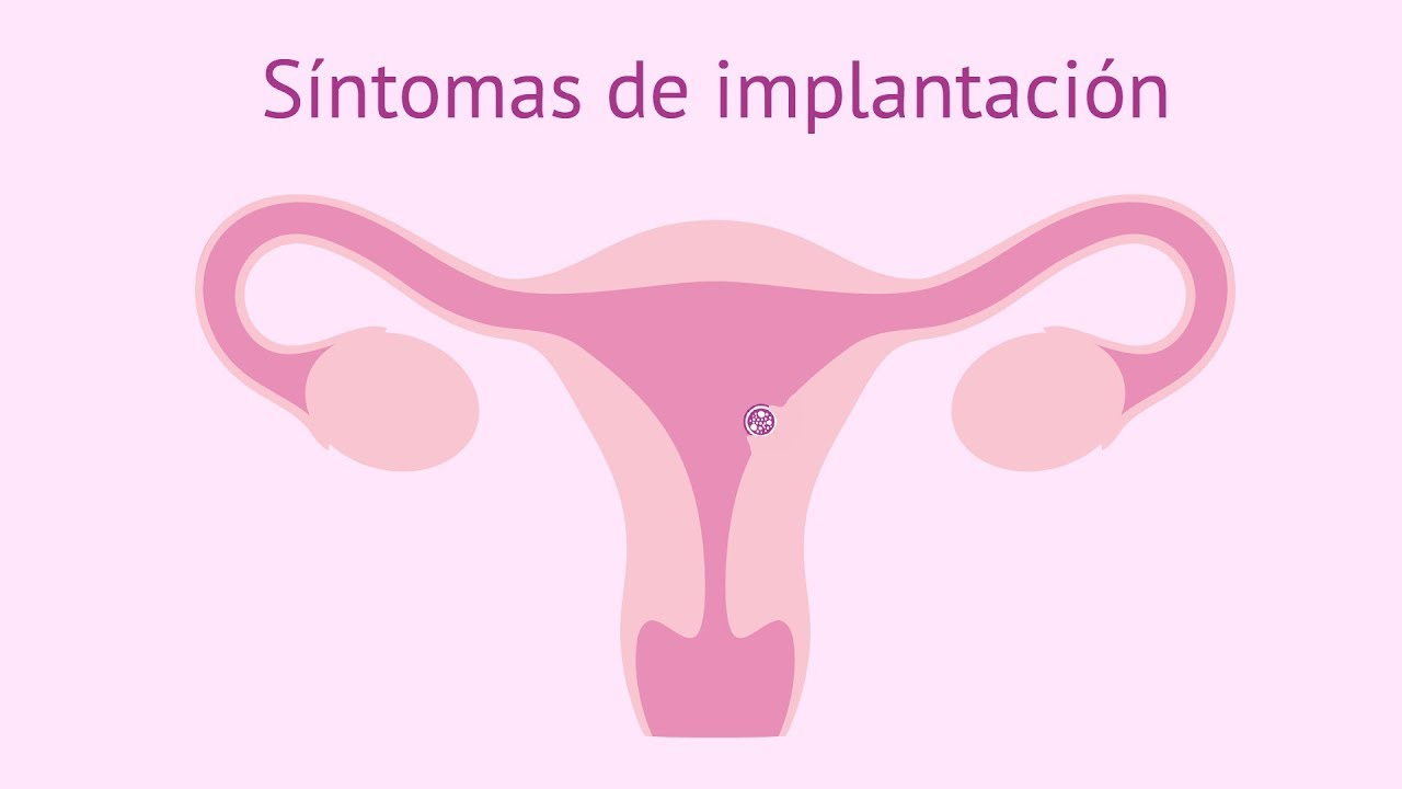 Síntomas de implantación del embrión